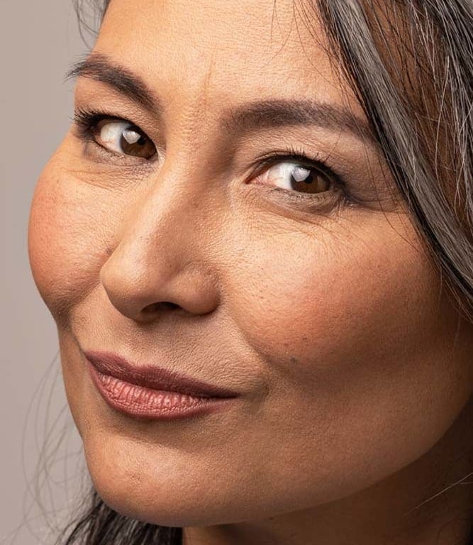 Anti Wrinkle Injections Gerrards Cross