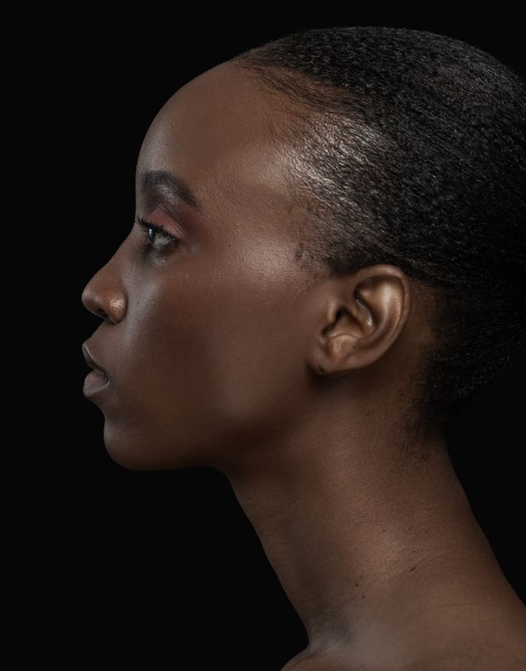 Refresh Medispa - Mole Checks & Skin Lesion Review At a Glance