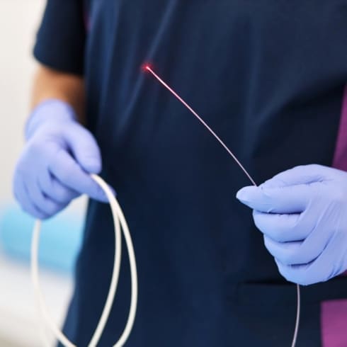 EVLA Treatment in Amersham, Buckinghamshire Endovenous Laser Treatment for Varicose Veins at Refresh Medispa