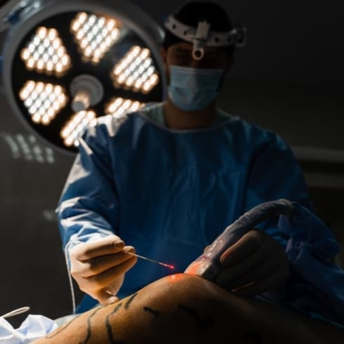 Evla vs Surgery for Varicose Veins Modern Laser Treatment Compared to Traditional Vein Stripping